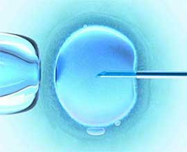 Hormonal Infertility
